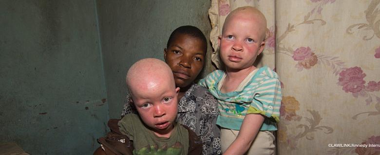 Malawi, le meurtre d'une petite fille albinos met en évidence l'urgente nécessité d'une meilleure protection 