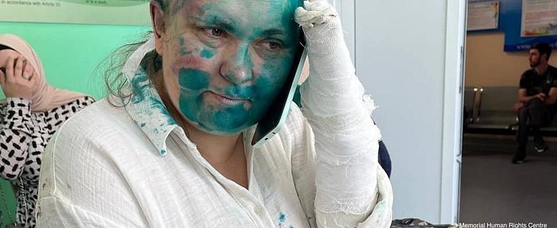 Elena Milachina plâtrée et aspergée de peinture bleue
